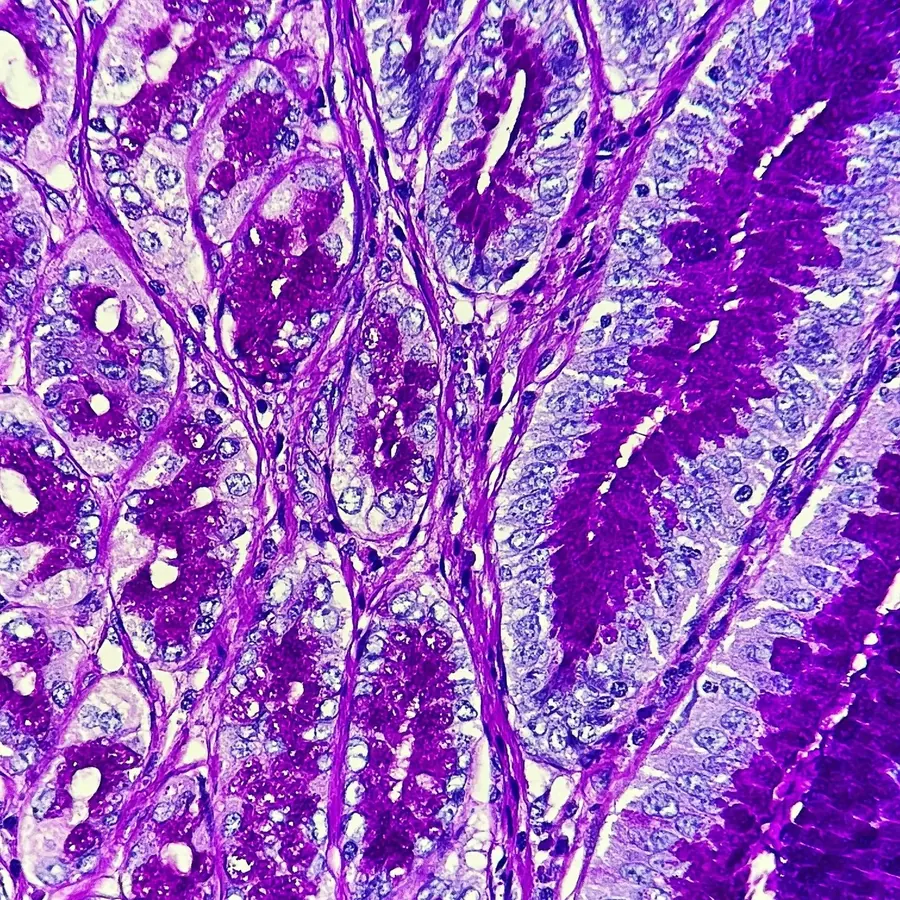 Histology section stained in purple tones