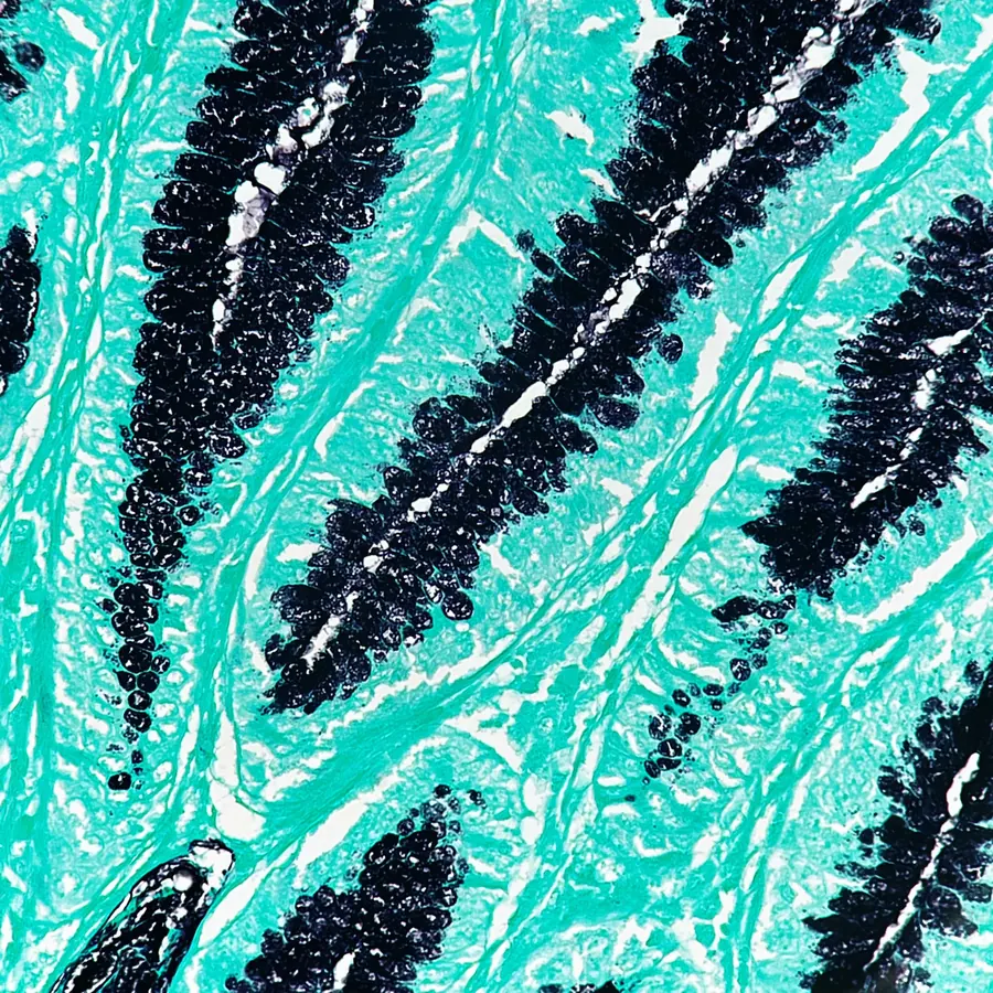 Histology section with special stain, teal and black