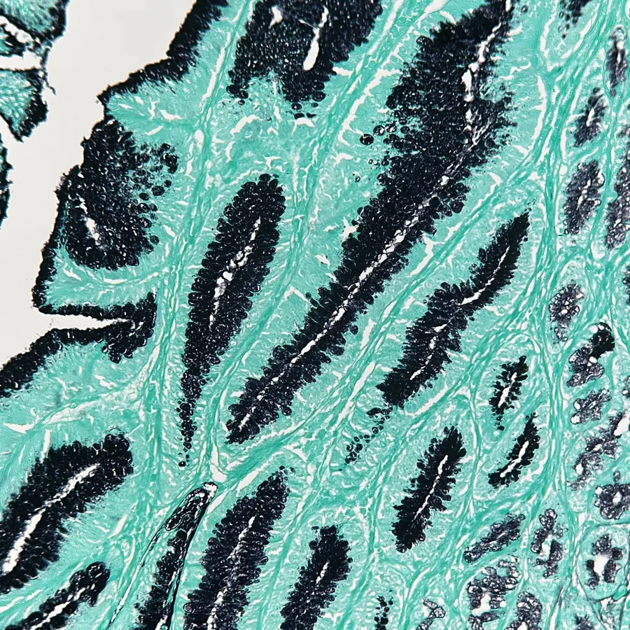 Wider field of the same special stain, showing a villous pattern